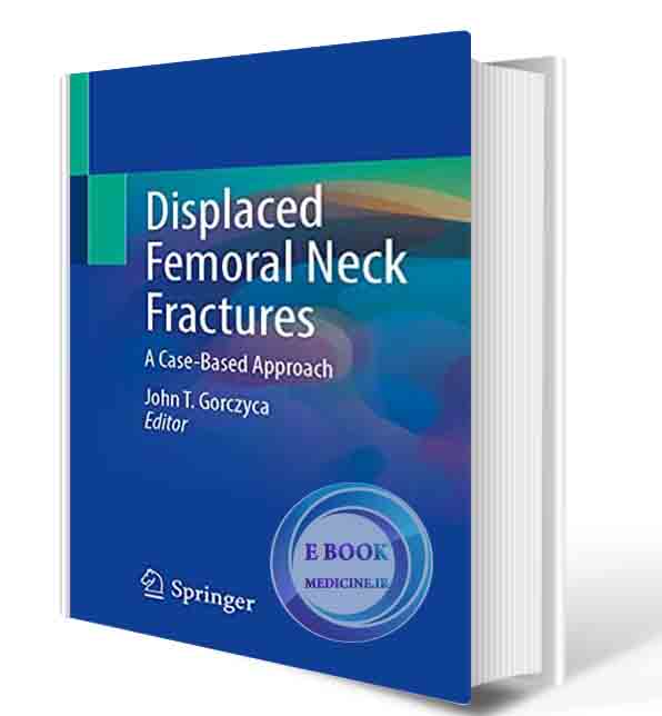 دانلود کتابDisplaced Femoral Neck Fractures: A Case-Based Approach 1st ed. 2022 (ORIGINAL PDF)